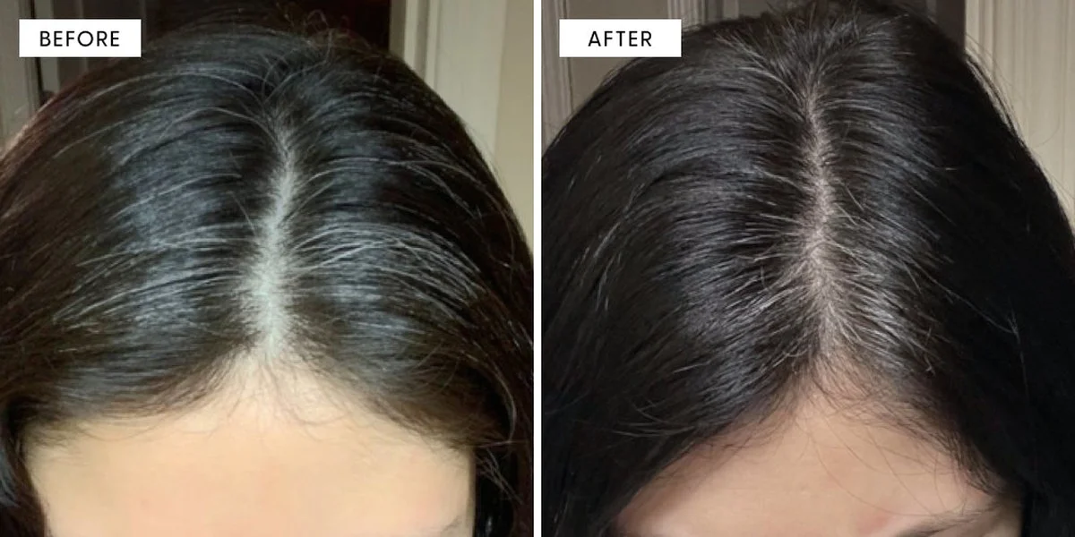 waaromexpertsnu-extra-2.webp Waarom experts nu stamcellen uit rozenblaadjes gebruiken om grijs haar te keren - image 2